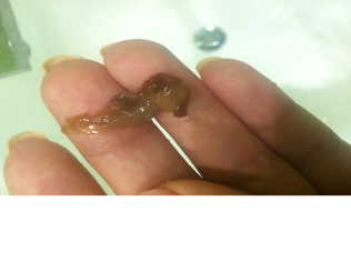 Якога колеру бываюць вылучэння – норма і рэальныя асцярогі